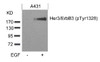 Western blot analysis of lysed extracts from A431 cells untreated or treated with EGF using Her3/ErbB3 (phospho-Tyr1328) .