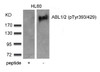 Western blot analysis of lysed extracts from HL60 cells using ABL1/2 (phospho-Tyr393/429) .