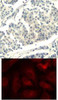 <b>Top Image:</b> Immunohistochemical analysis of paraffin-embedded human breast carcinoma tissue using ABL1/2 (Phospho-Tyr393/429) .<b>Bottom Image:</b> Immunofluorescence staining of methanol-fixed HeLa cells using ABL1/2 (phospho-Tyr393/429) .