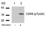 Western blot analysis of lysed extracts from 293 cells untreated (Lane 1) or treated with starvation (lane 2) using CDK6 (phospho-Tyr24) .