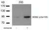 Western blot analysis of lysed extracts from 293 cells untreated or treated with Hydroxyurea using MDM2 (phospho-Ser166) .