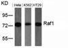 Western blot analysis of lysed extracts from HeLa, K562 and HT29 cells using Raf1 (Ab-259) .