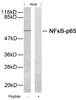 Western blot analysis of lysed extracts from HeLa cells using NF&#954;B-p65 (Ab-276) .
