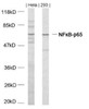 Western blot analysis of lysed extracts from HeLa and 293 cells using NF&#954;B-p65 (Ab-468) .