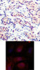 <b>Top Image:</b> Immunohistochemical analysis of paraffin-embedded human breast carcinoma tissue using JunD (Ab-255) .<b>Bottom Image:</b> Immunofluorescence staining of methanol-fixed HeLa cells using JunD (Ab-255) .