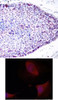 <b>Top Image:</b> Immunohistochemical analysis of paraffin-embedded human breast carcinoma tissue using ATF2 (Ab-62 or 44) .<b>Bottom Image:</b> Immunofluorescence staining of methanol-fixed HeLa cells using ATF2 (Ab-62 or 44) .