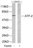 Western blot analysis of lysed extracts from LOVO cells using ATF2 (Ab-69 or 51) .