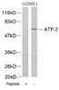 Western blot analysis of lysed extracts from LOVO cells using ATF2 (Ab-73 or 55) .