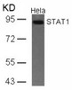 Western blot analysis of lysed extracts from HeLa, A431 and JK cells using STAT1 (Ab-701) .