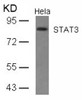 Western blot analysis of lysed extracts from HeLa cells using STAT3 (Ab-727) .
