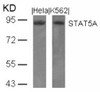 Western blot analysis of lysed extracts from HeLa and K562 cells using STAT5A (Ab-694) .