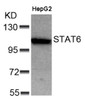 Western blot analysis of lysed extracts from HepG2 cells using STAT6 (Ab-641) .