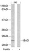 Western blot analysis of lysed extracts from 293 cells using BAD (Ab-155) .
