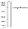 Western blot analysis of lysed extracts from MCF cells using Estrogen Receptor-&#945; (Ab-167) .
