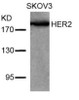 Western blot analysis of lysed extracts from SKOV3 cells using HER2 (Ab-877) .