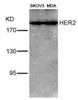 Western blot analysis of lysed extracts from SKOV3 and MDA cells using HER2 (Ab-1221/1222) .