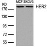 Western blot analysis of lysed extracts from MCF and SKOV3 cells using HER2 (Ab-1248) .
