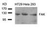 Western blot analysis of lysed extracts from HT29, HeLa and 293 cells using FAK (Ab-861) .