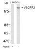 Western blot analysis of lysed extracts from SKOV3 cells using VEGFR2 (Ab-951) .