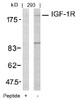 Western blot analysis of lysed extracts from 293 cells using IGF-1R (Ab-1161) .