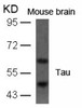 Western blot analysis of lysed extracts from mouse brain tissue using Tau (Ab-396) .