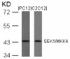Western blot analysis of lysed extracts from PC12 and C2C12 cells using SEK1/MKK4 (Ab-80) .