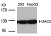Western blot analysis of lysed extracts from 293 and HepG2 cells using HDAC5 (Ab-498) .