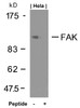 Western blot analysis of lysed extracts from HeLa cells using FAK (Ab-925) .
