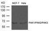 Western blot analysis of lysed extracts from MCF-7 and HeLa cells using PAK1/PAK2/PAK3 (Ab-423/402/421) .