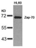 Western blot analysis of lysed extracts from HL60 cells using Zap-70 (Ab-319) .