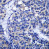 Immunohistochemical analysis of paraffin-embedded human tonsil tissue using Zap-70 (Ab-319) .