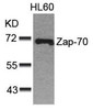 Western blot analysis of lysed extracts from HL60 cells using Zap-70 (Ab-493) .