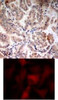 <b>Top Image:</b> Immunohistochemical analysis of paraffin-embedded human breast carcinoma tissue using AMPK&#945;1/AMPK&#945;2 (Ab-174/172) .<b>Bottom Image:</b> Immunofluorescence staining of methanol-fixed HeLa cells using AMPK&#945;1/AMPK&#945;2 (Ab-174/172) .