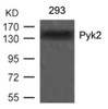 Western blot analysis of lysed extracts from 293 cells using Pyk2 (Ab-402) .