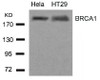 Western blot analysis of lysed extracts from HeLa and HT29 cells using BRCA1 (Ab-1423) .