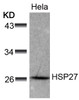 Western blot analysis of lysed extracts from HeLa cells using HSP27 (Ab-78) .