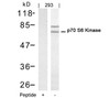 Western blot analysis of lysed extracts from 293 cells using p70 S6 Kinase (Ab-421) .