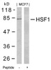 Western blot analysis of lysed extracts from MCF7 cells using HSF1 (Ab-303) .