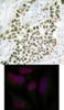 <b>Top Image:</b> Immunohistochemical analysis of paraffin-embedded human breast carcinoma tissue using Histone H2A.X (Ab-139) .<b>Bottom Image:</b> Immunofluorescence staining of methanol-fixed HeLa cells using Histone H2A.X (Ab-139) .