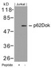 Western blot analysis of lysed extracts from Jurkat cells using p62Dok (Ab-362) .