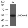 Western blot analysis of lysed extracts from JK cells using p56Dok-2 (Ab-299) .