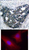 <b>Top Image:</b> Immunohistochemical analysis of paraffin-embedded human breast carcinoma tissue using p56Dok-2 (Ab-299) .<b>Bottom Image:</b> Immunofluorescence staining of methanol-fixed HeLa cells using p56Dok-2 (Ab-299) .