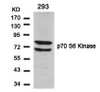 Western blot analysis of lysed extracts from 293 cells using p70 S6 Kinase (Ab-424) .