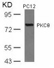 Western blot analysis of lysed extracts from PC12 cells using PKC&#920; (Ab-676) .