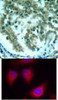 <b>Top Image:</b> Immunohistochemical analysis of paraffin-embedded human lung carcinoma tissue using PKC&#920; (Ab-676) .<b>Bottom Image:</b> Immunofluorescence staining of methanol-fixed HeLa cells using PKC&#920; (Ab-676) .