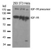 Western blot analysis of lysed extracts from 293, 3T3 and HeLa cells using IGF-1R (Ab-1280) .