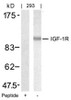 Western blot analysis of lysed extracts from 293 cells using IGF-1R (Ab-1346) .