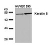 Western blot analysis of lysed extracts from HUVEC and 293 cells using Keratin 8 (Ab-74) .
