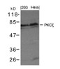 Western blot analysis of extract from 293 cells and HeLa using PKCzeta (Ab-410) .