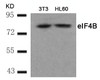 Western blot analysis of lysed extracts from 3T3 and HL60 cells using eIF4B (Ab-422) .